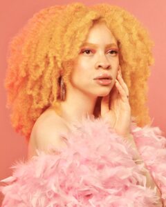 A young black woman with albinism, covered with pink feather, curly hair, holding her hand to her face.